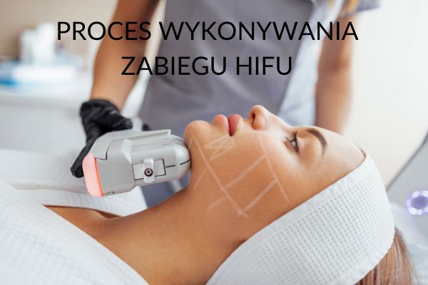 HIFU Warszawa