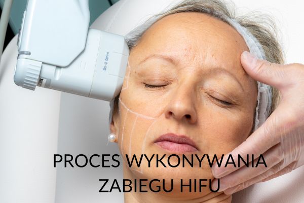 HIFU Warszawa