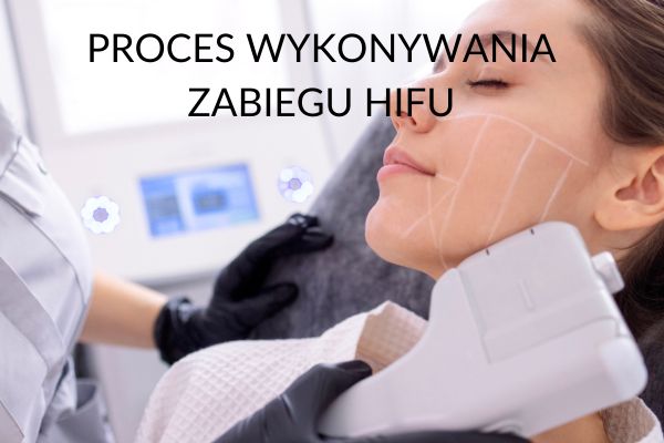 HIFU na Chomiki Warszawa