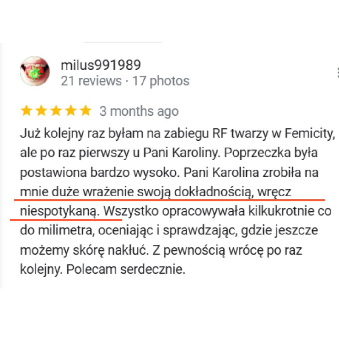 opinia o zabiegu radiofrekwencji mikroigłowej