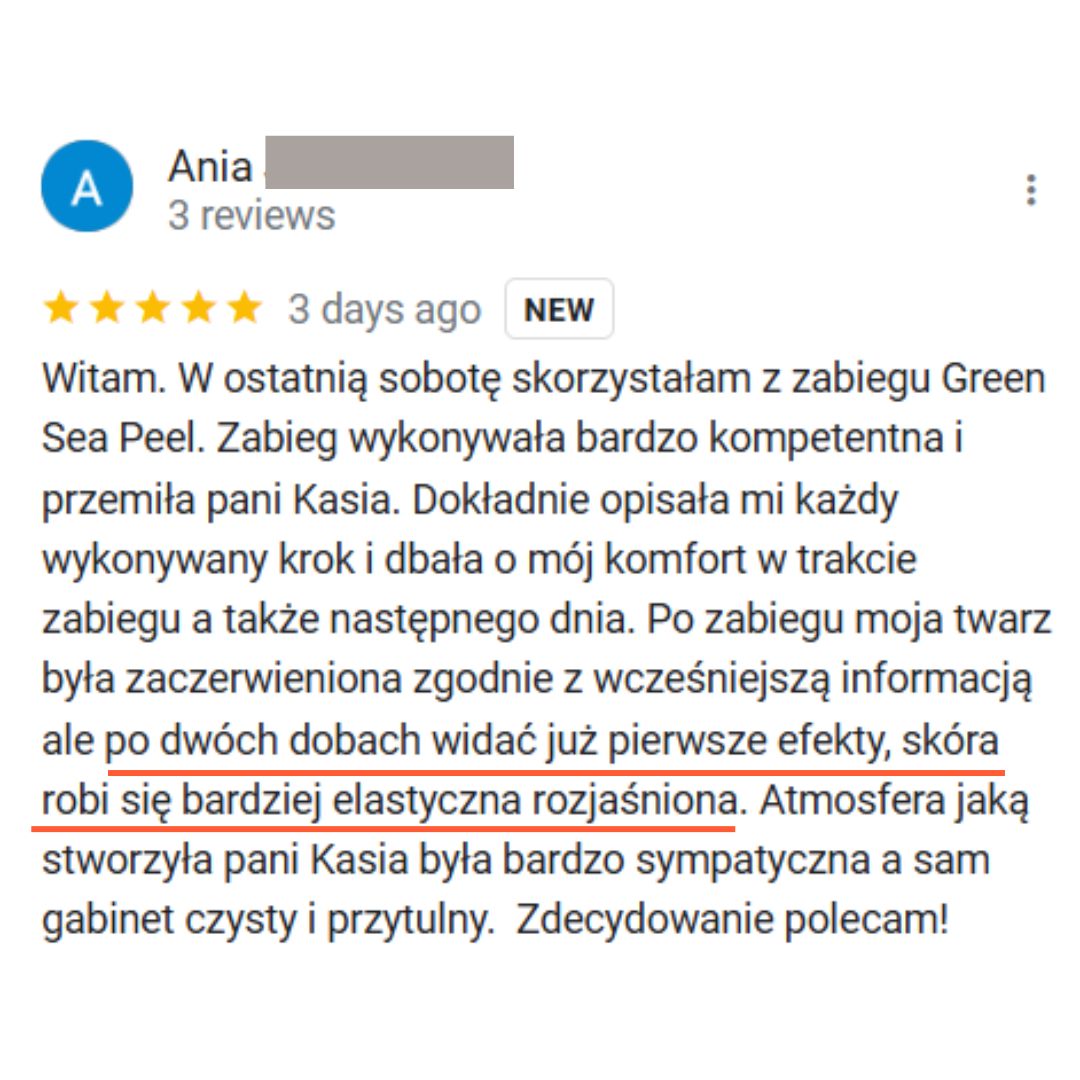 opinie o zabiegu green sea peel